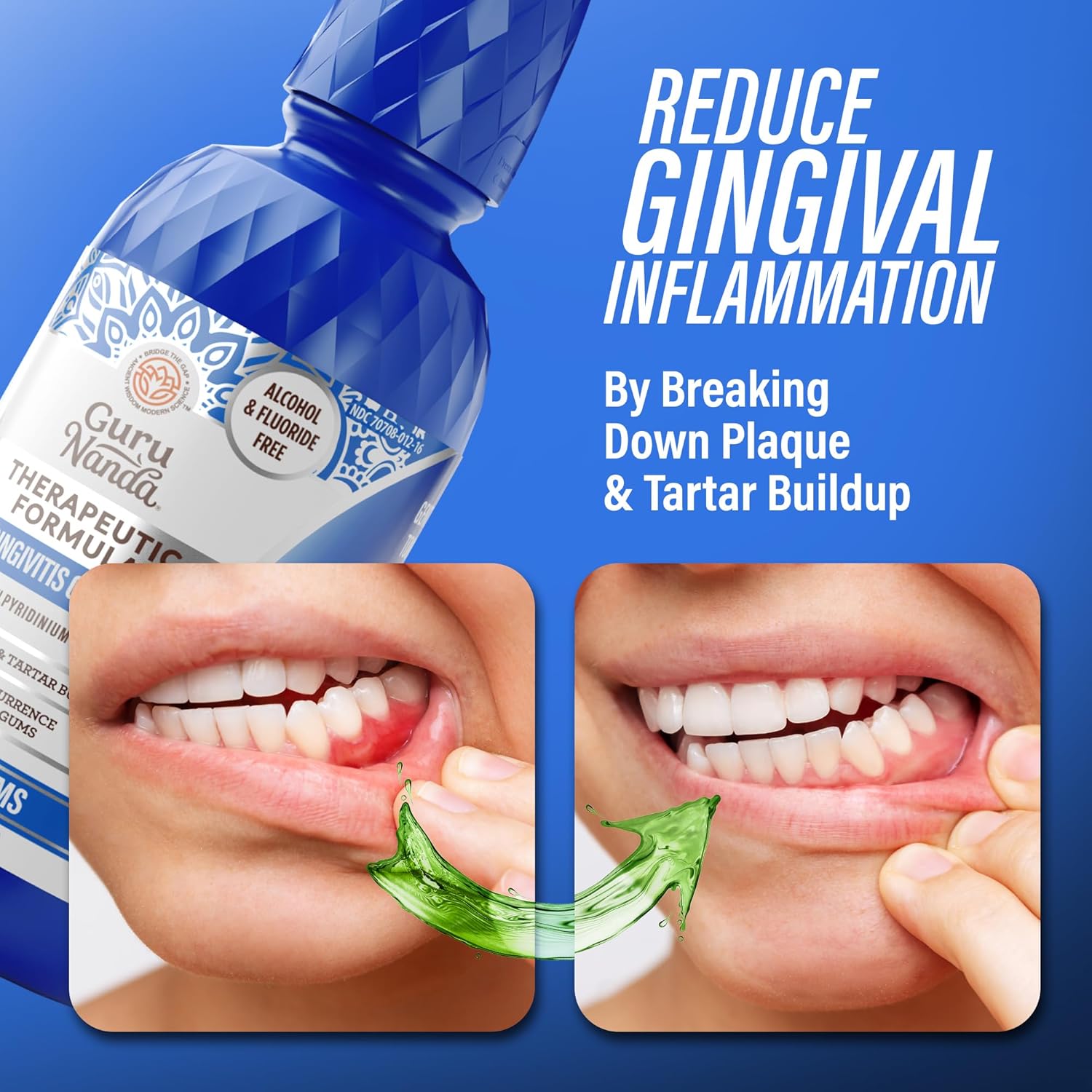 GuruNanda Fresh Breath Rinse