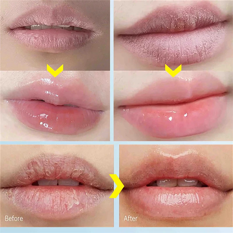 Healing Lip Care Stick
